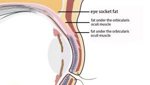 Intraorbital structure