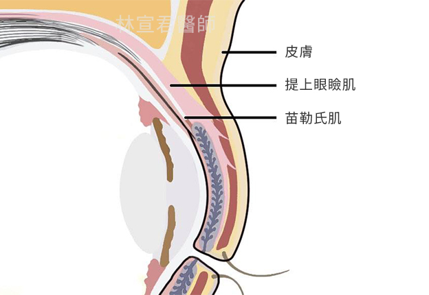 提上眼瞼肌構造圖