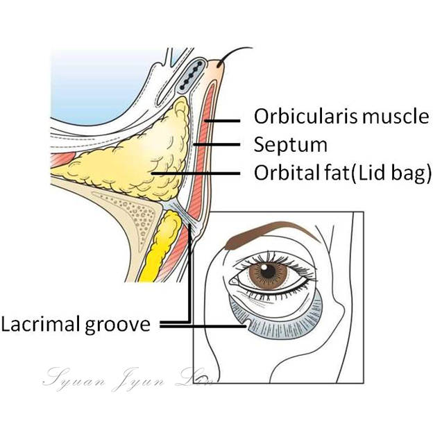 Eye bag structure