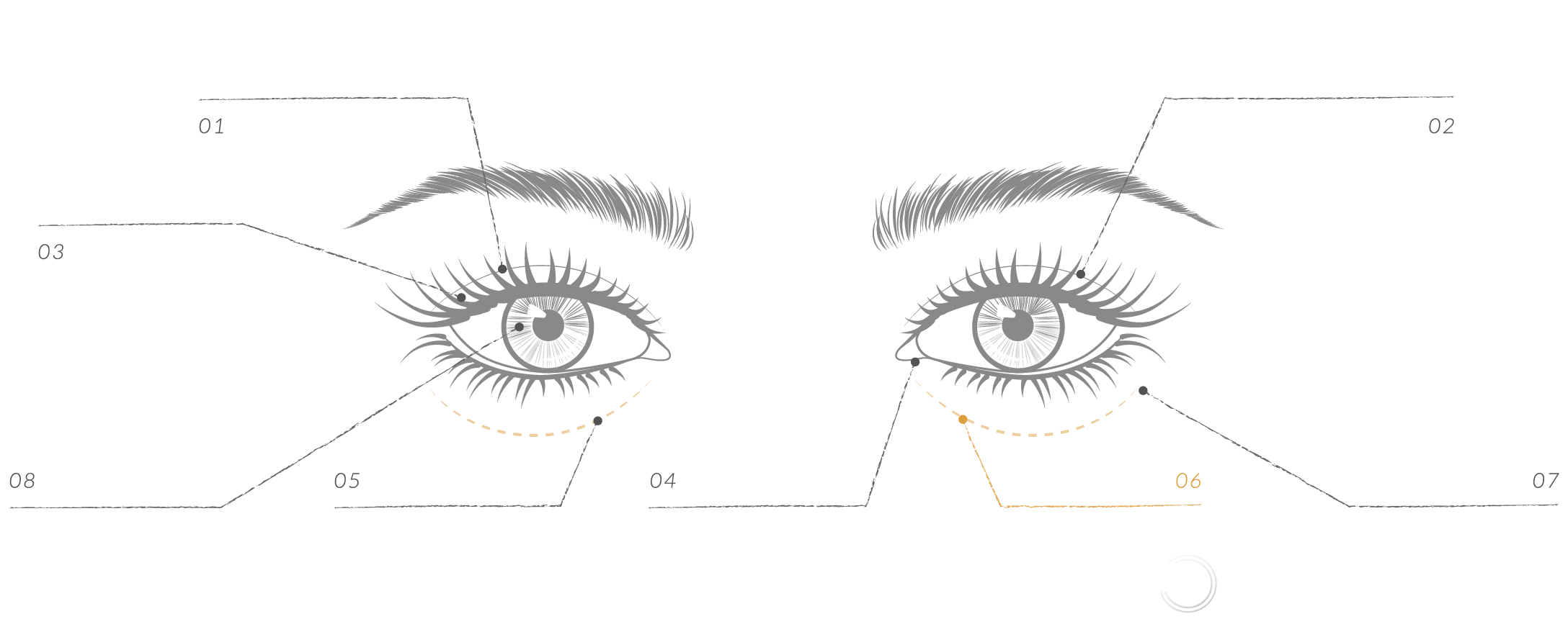 Category of Eyes Surgery-Eye Bag Surgery