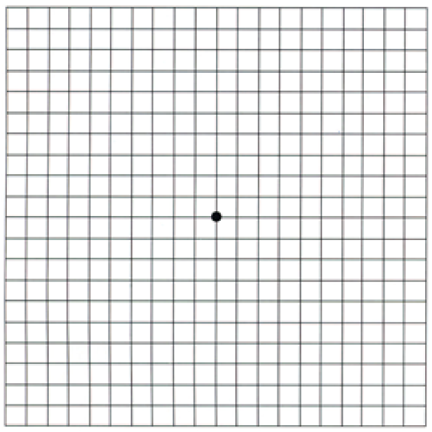 Amsler Grid-The test of age-related macular degeneration